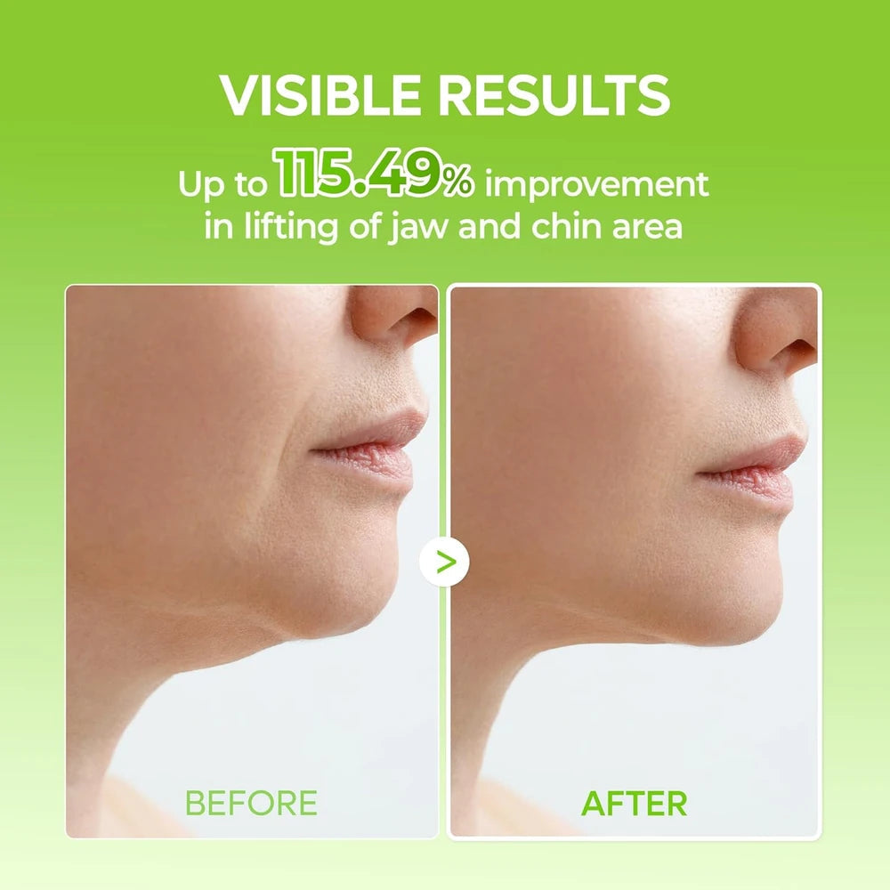 Clariva JawLift® — Bande Tenseur Contour Visage